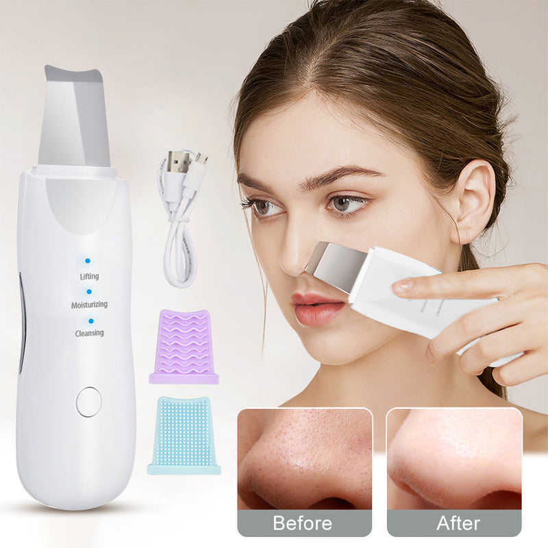 Ultrasonic Skin Scrubber Facial Pore Cleaner