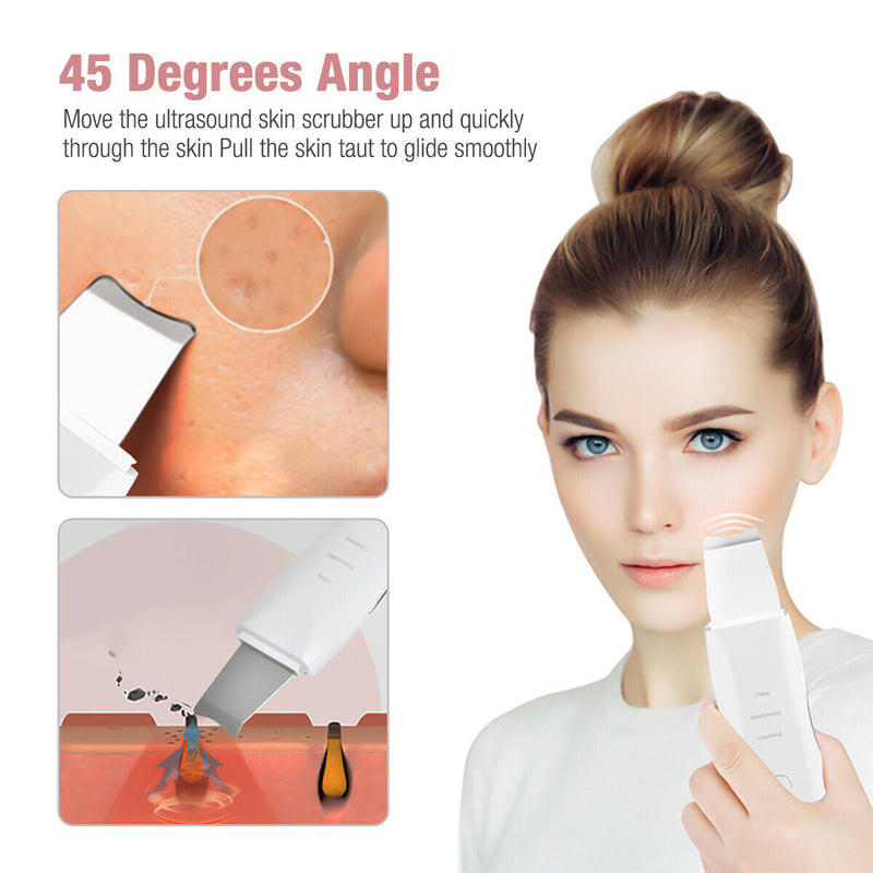 Ultrasonic Skin Scrubber Facial Pore Cleaner