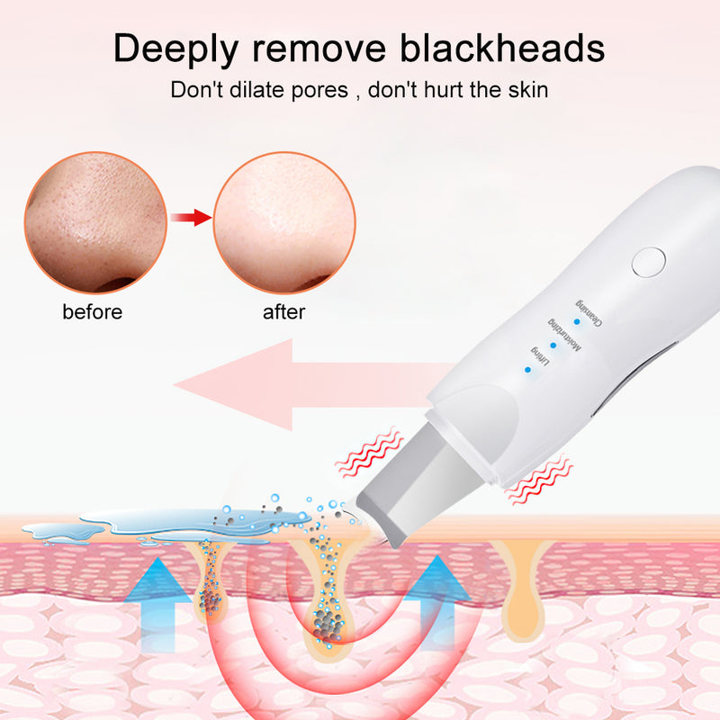 Ultrasonic Skin Scrubber Facial Pore Cleaner