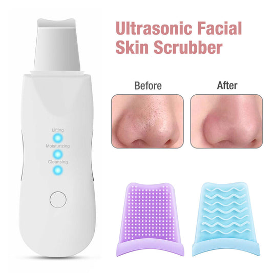 Ultrasonic Skin Scrubber Facial Pore Cleaner